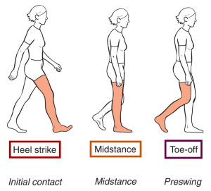 High Heels And Scoliosis: Effects And Prevention